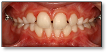 dents orthodontiste bordeaux docteur