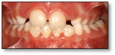 dents orthodontiste bordeaux